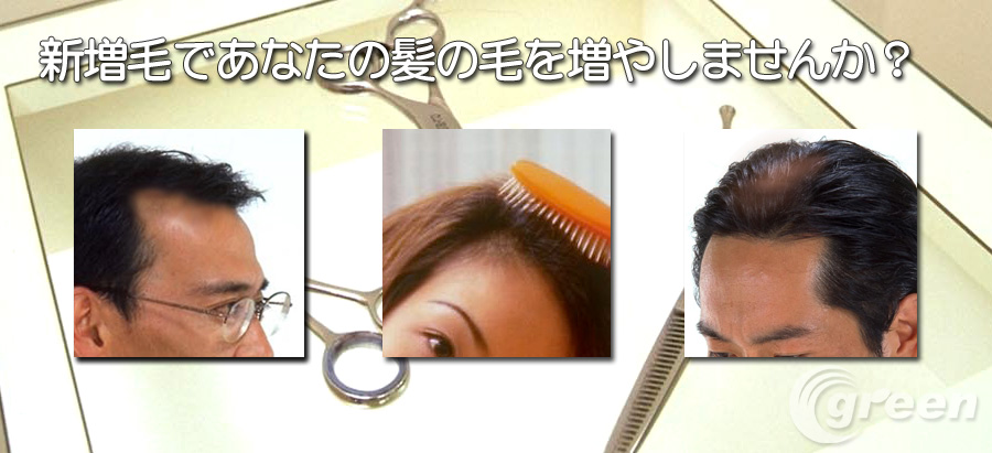 新増毛であなたの髪の毛を増やしませんか？